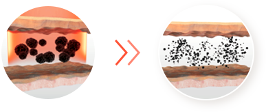 기존 자사 나노 레이저 관련 이미지